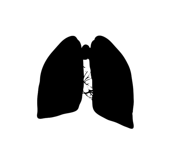 Fibrose pulmonar