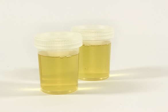 A formação da urina e a sua eliminação